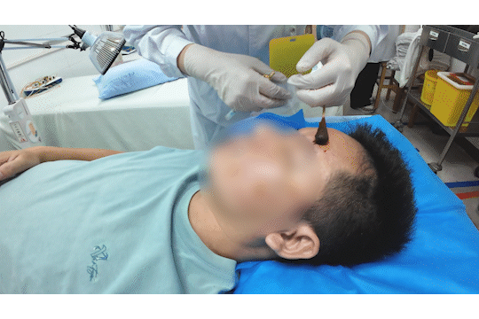 皇冠信用網代理出租
_醒来“天塌了”皇冠信用網代理出租
!深圳一女子眼睛闭不上、嘴巴漏水!这些错误很多人会犯