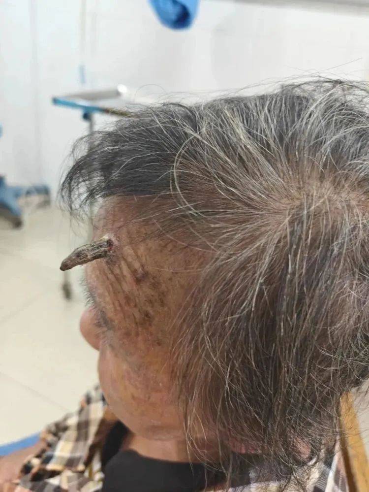 圣保利vs多特蒙德_太突然！上海98岁阿婆拿起剪刀圣保利vs多特蒙德，一把剪掉头上的“角”！网友：对自己够狠