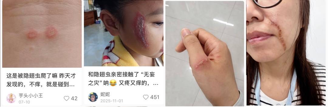 皇冠信用_北京已有人中招皇冠信用，千万不能拍，毒液堪比硫酸，会毁容——